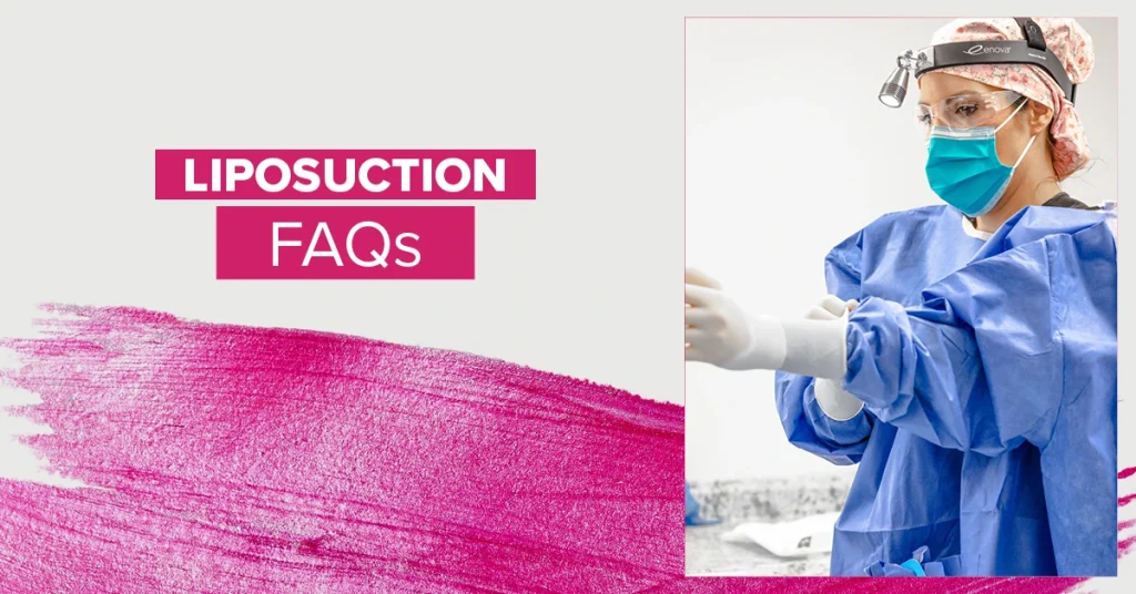 Dr. Caplin Plastic Surgeon Liposuction FAQs - CSA