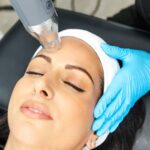 The Key to Eliminating Acne Scars