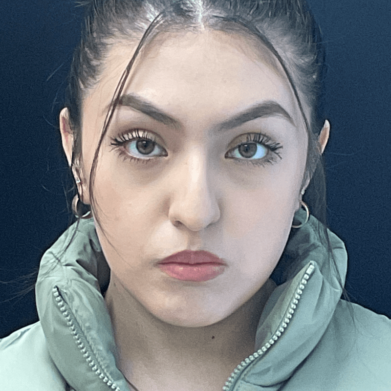 Rhinoplasty CSA